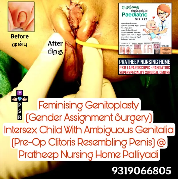 Clinical images relating to genitoplasty and disorders of sexual development