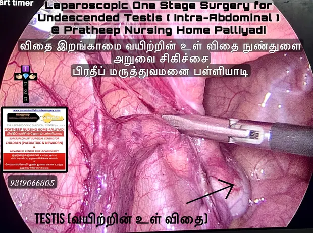 Operative photographs from laparoscopic procedures