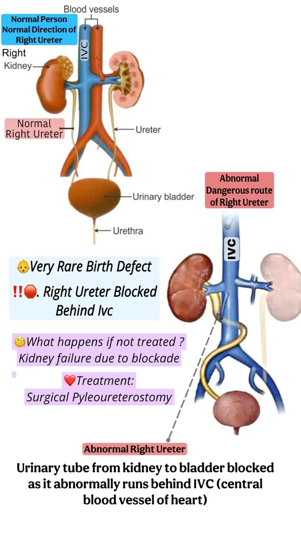 Operative photograph from surgery for kidney disease
