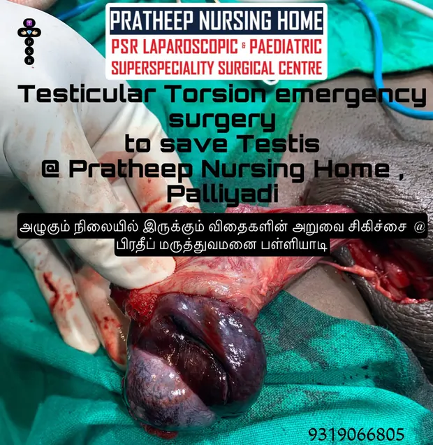 Operative photograph from emergency testicular torsion surgery