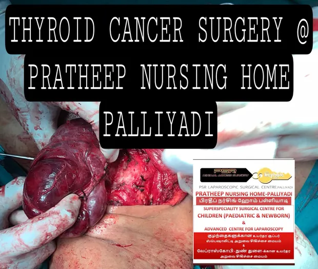 Operative photograph from thyroid cancer surgery