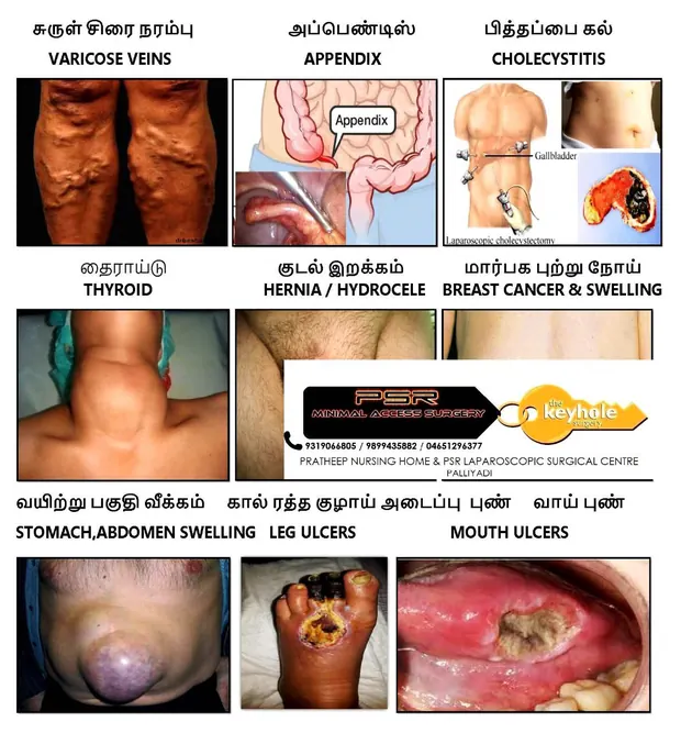 Hospital chart showing conditions treated including varicose veins, appendix, gallstones, thyroid and hernia